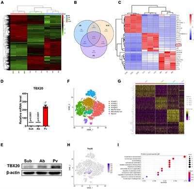 TBX20 Contributes to Balancing the Differentiation of Perivascular Adipose-Derived Stem Cells to Vascular Lineages and Neointimal Hyperplasia